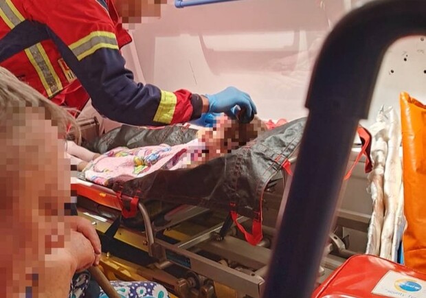 В Купянске во время обстрела ранена 6-летняя девочка. Фото: Харьковская облпрокуратура